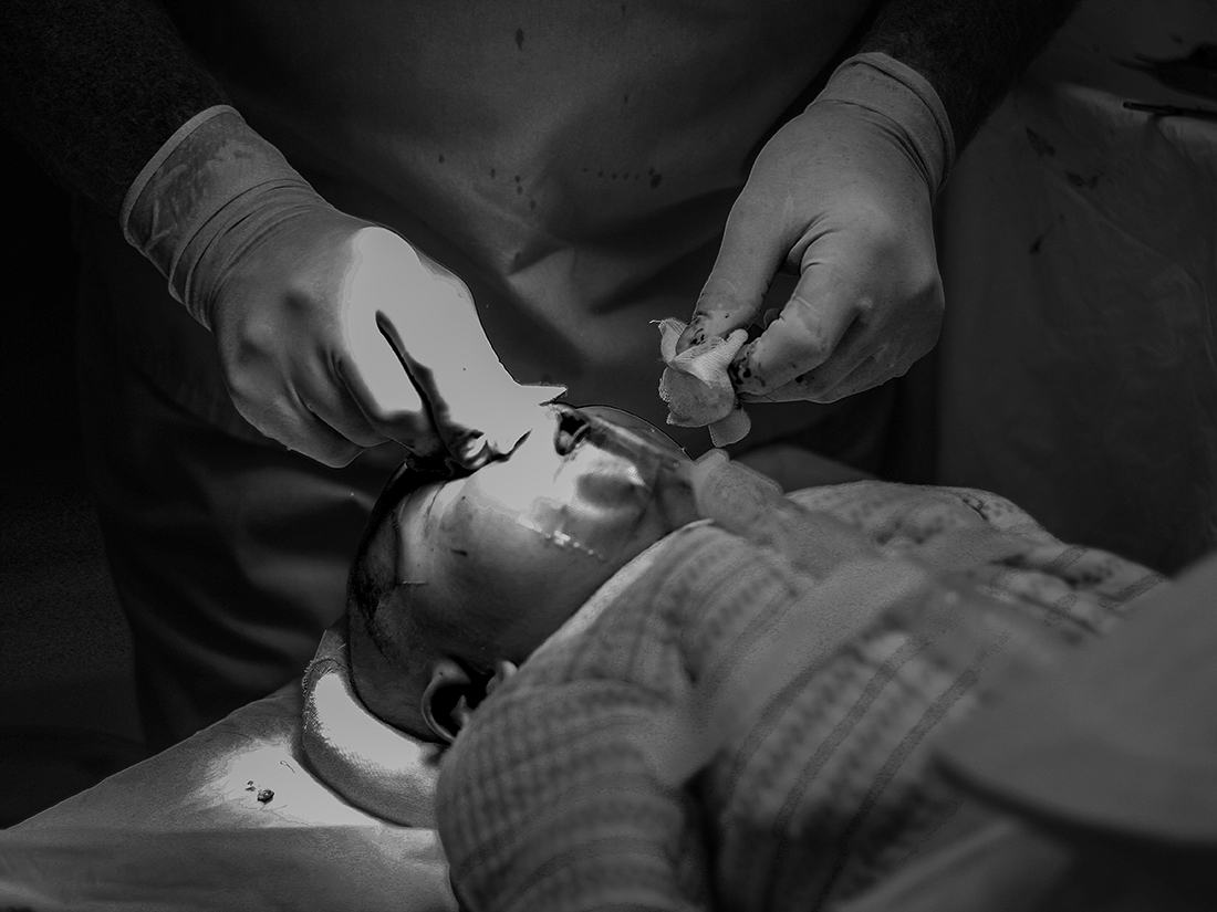 Helping Children Smile Again
