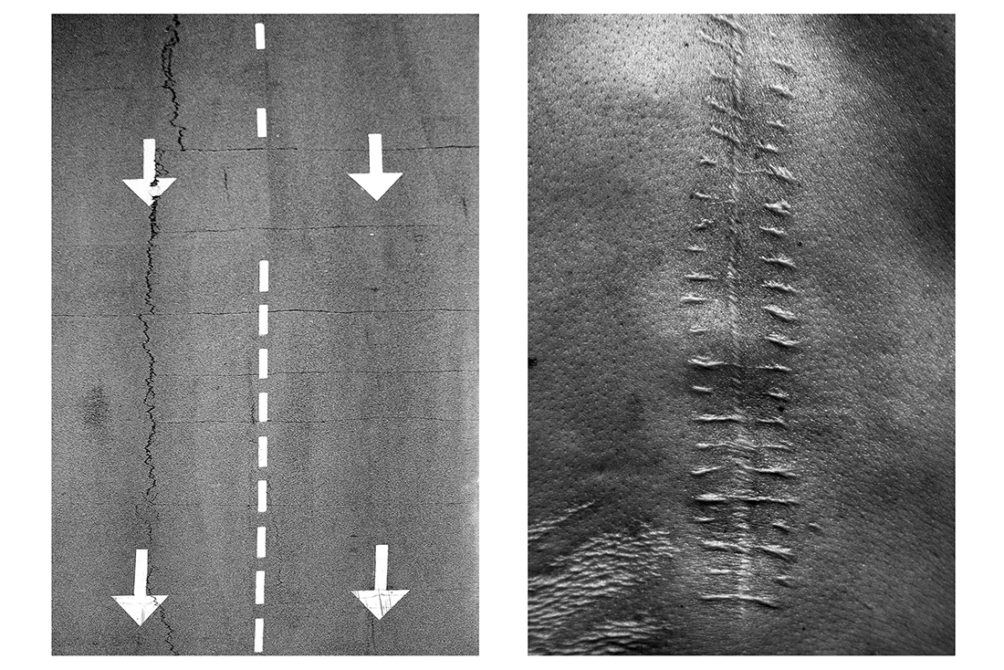 Spine