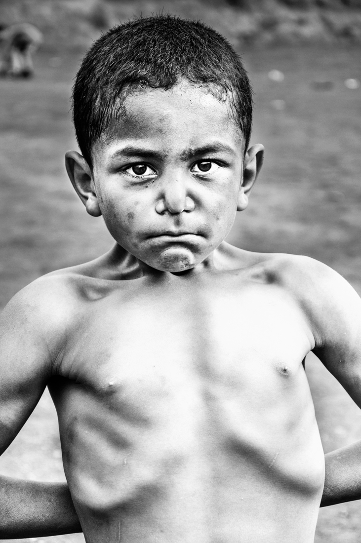 Childhood Displaced