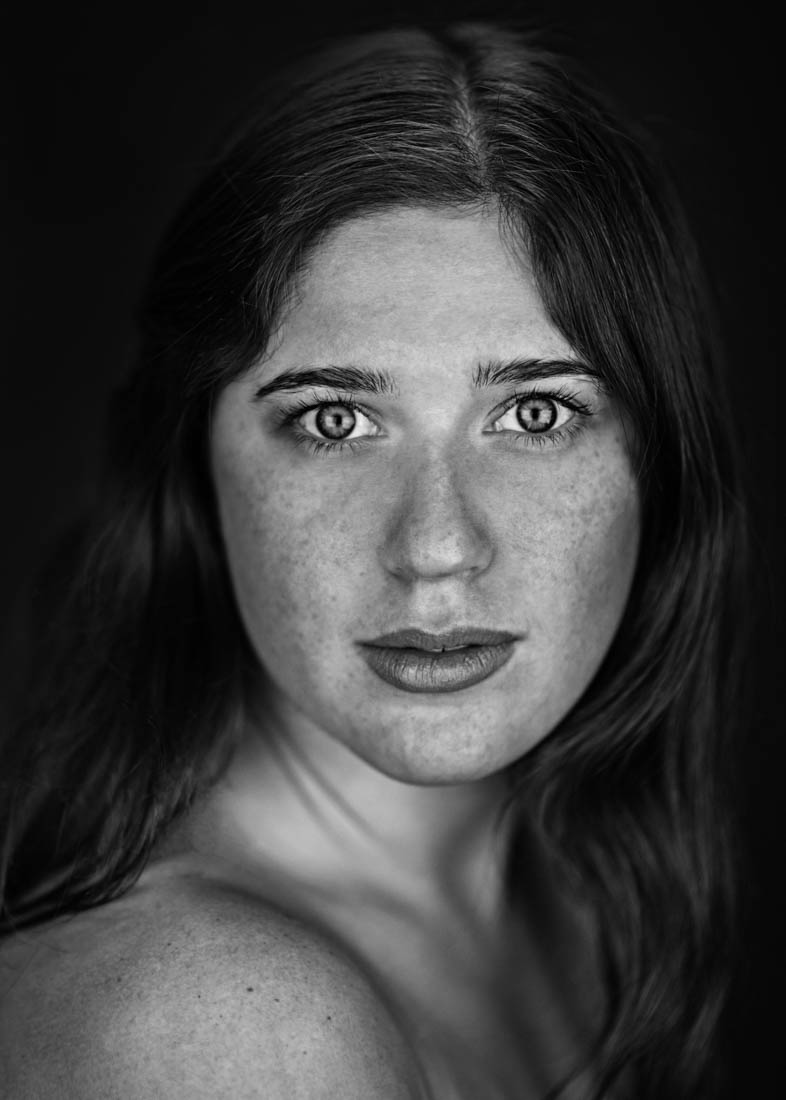 Freckles