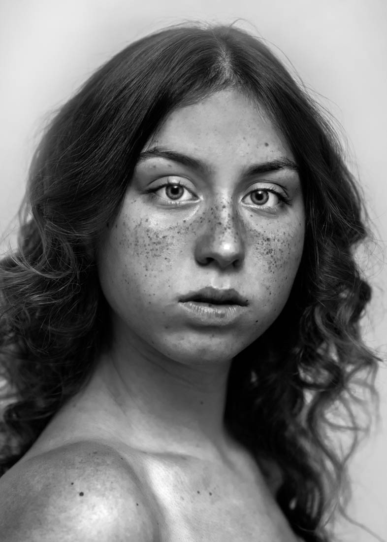 Freckles