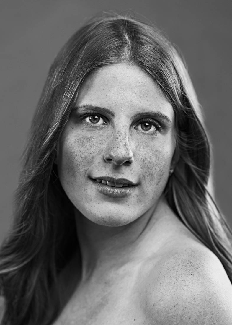 Freckles
