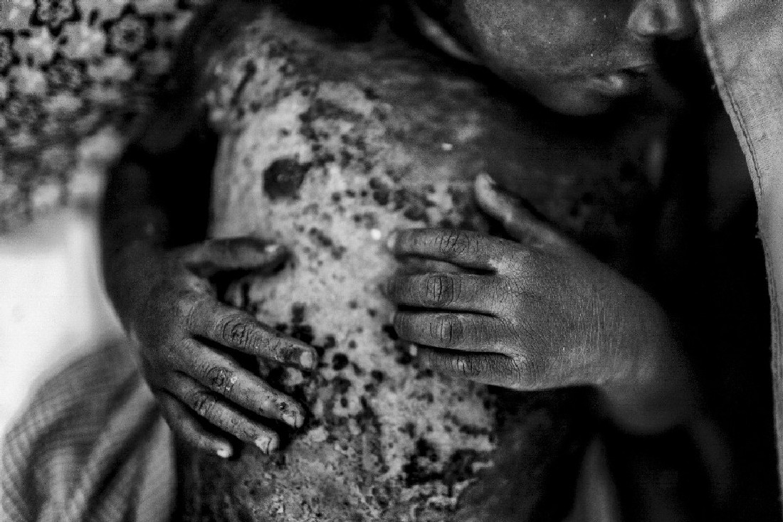 I am Rohingya