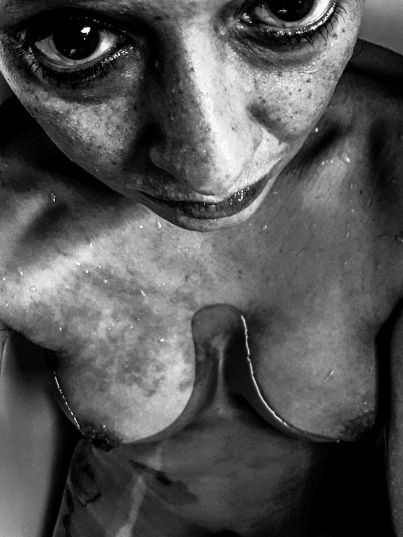 My skin and me