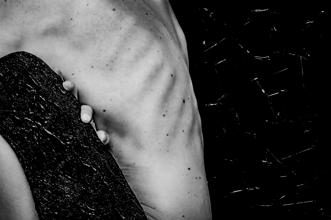Body texture
