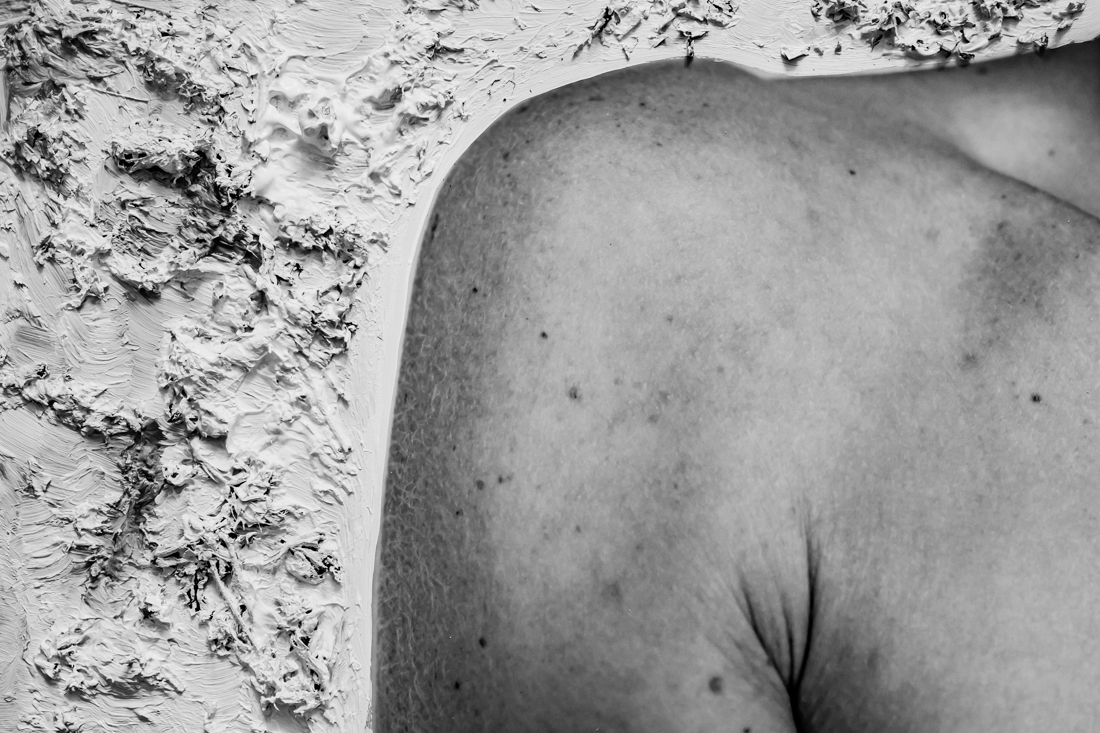 Body texture