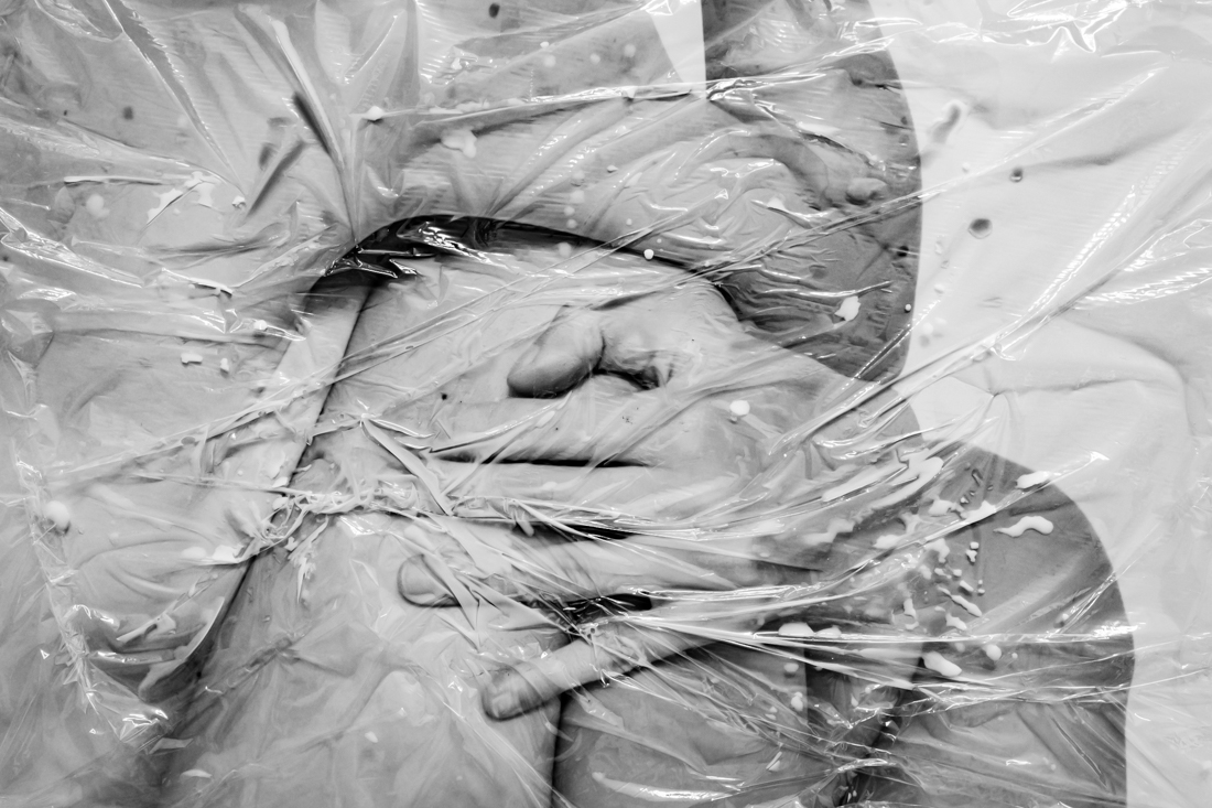 Body texture