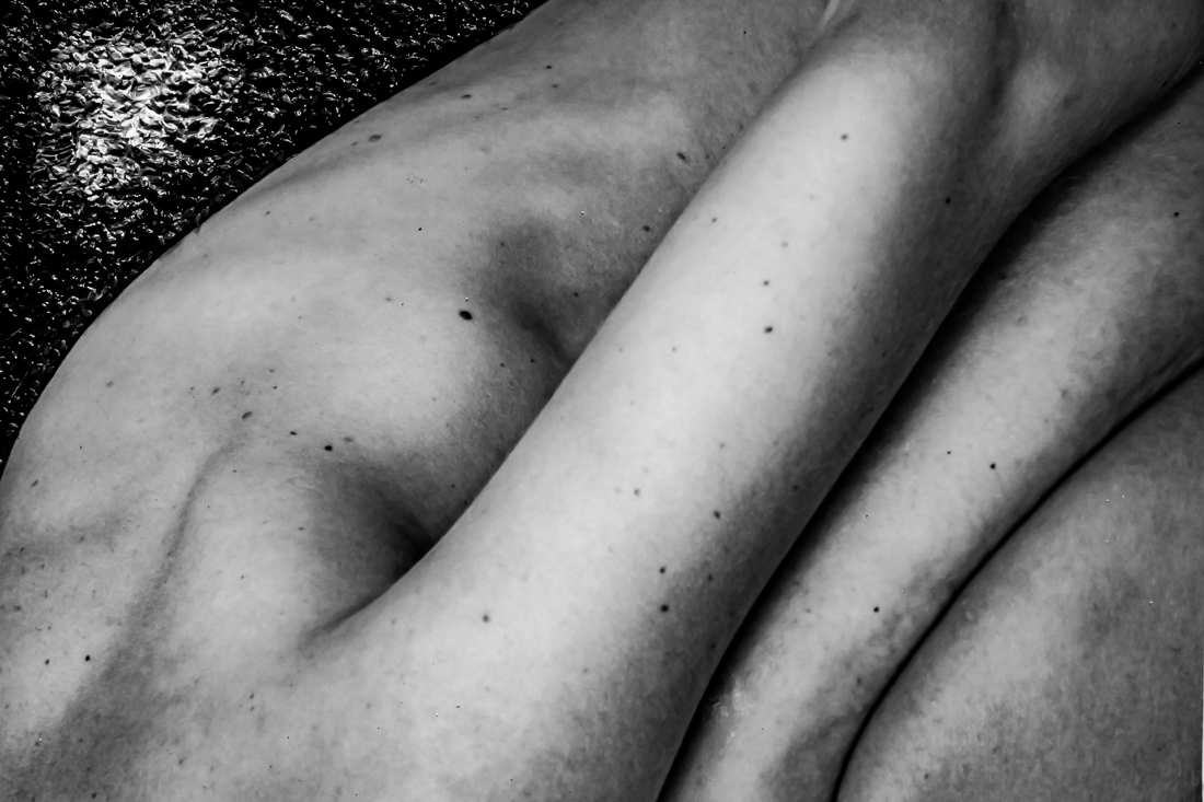 Body texture