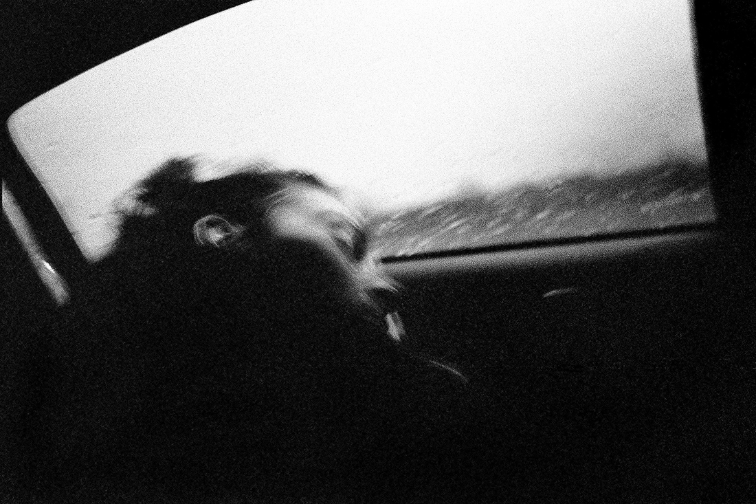 Under the eyes that few minutes exhist