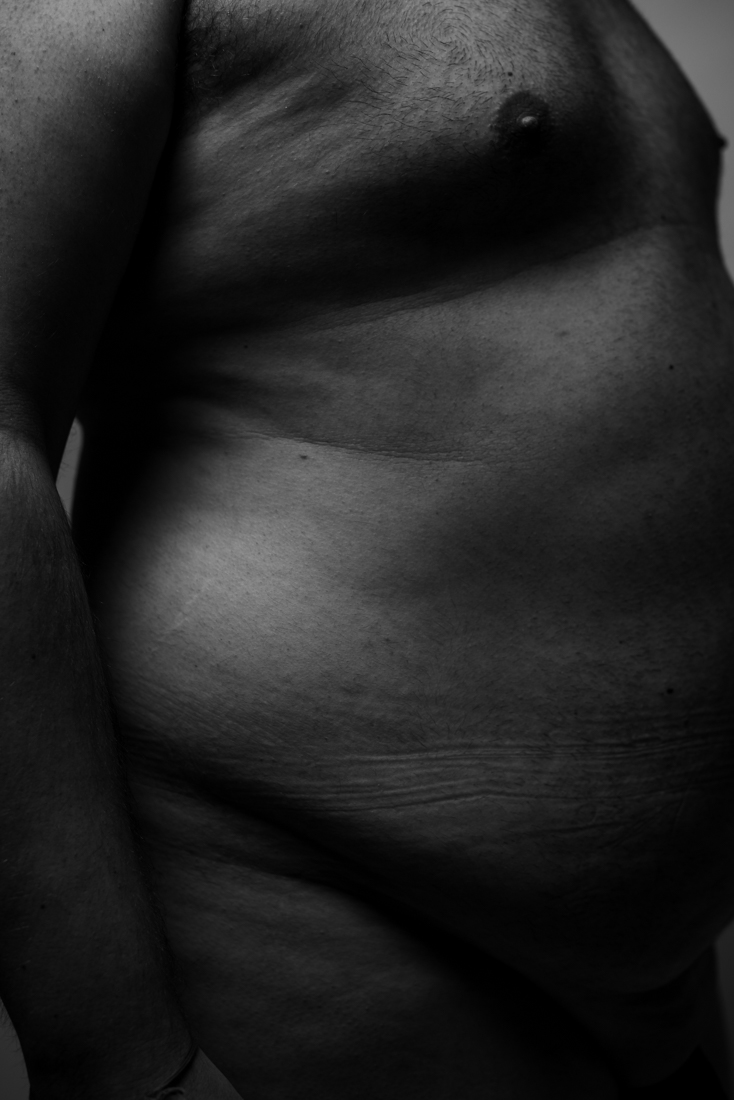 Bodies imPerfection
