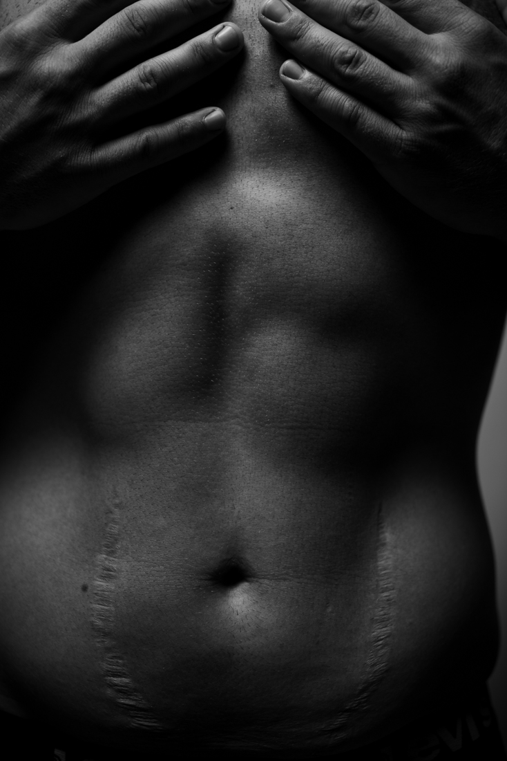 Bodies imPerfection