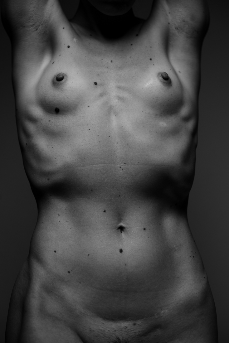 Bodies imPerfection