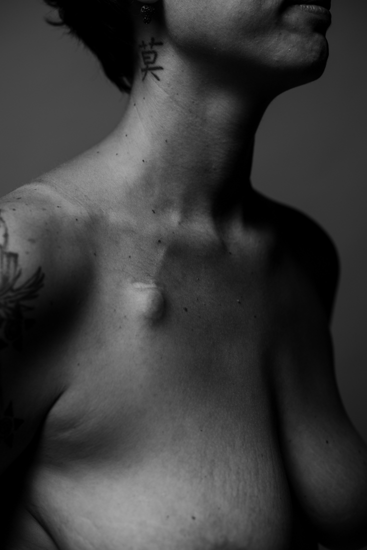 Bodies imPerfection