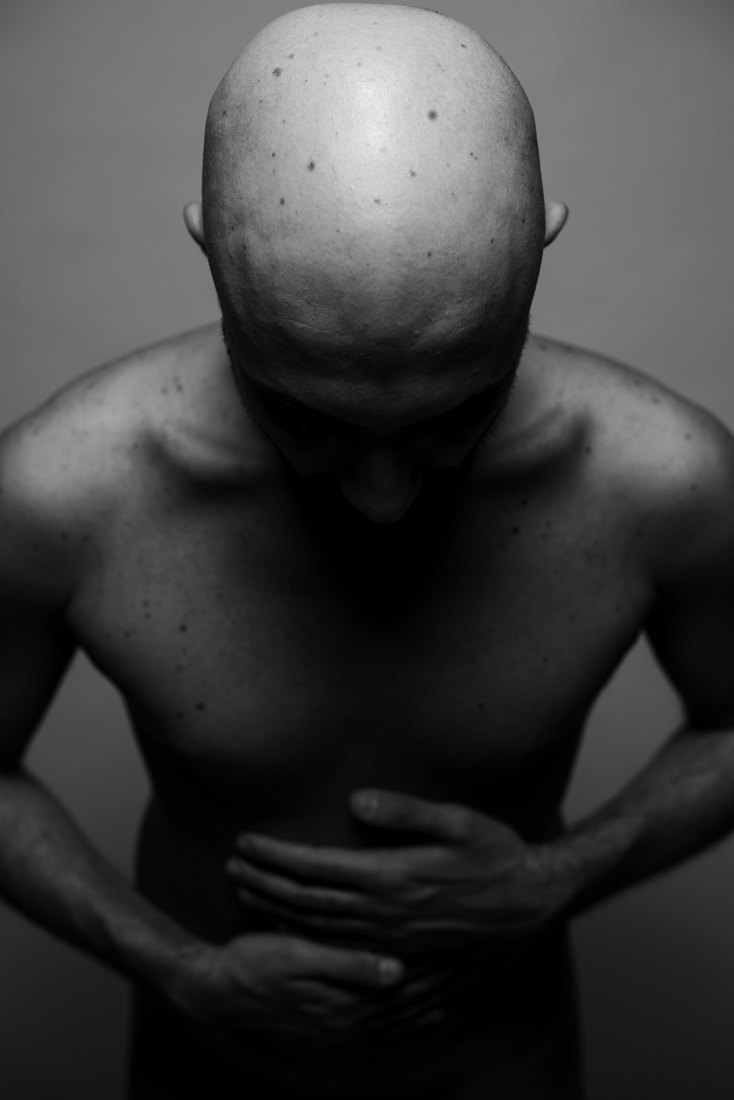 Bodies imPerfection