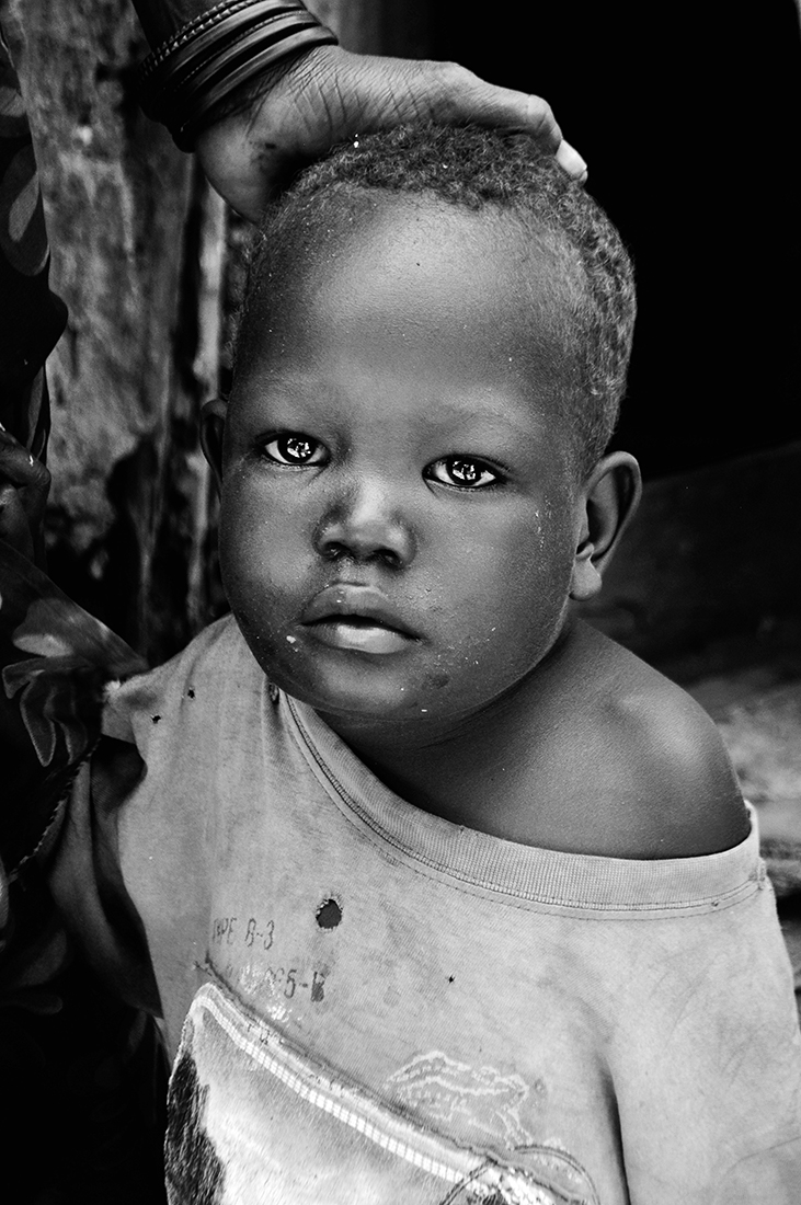 Life in slums