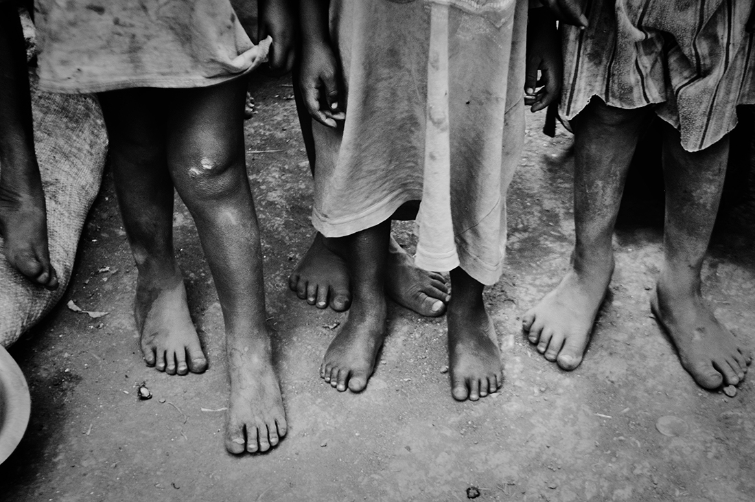 Life in slums