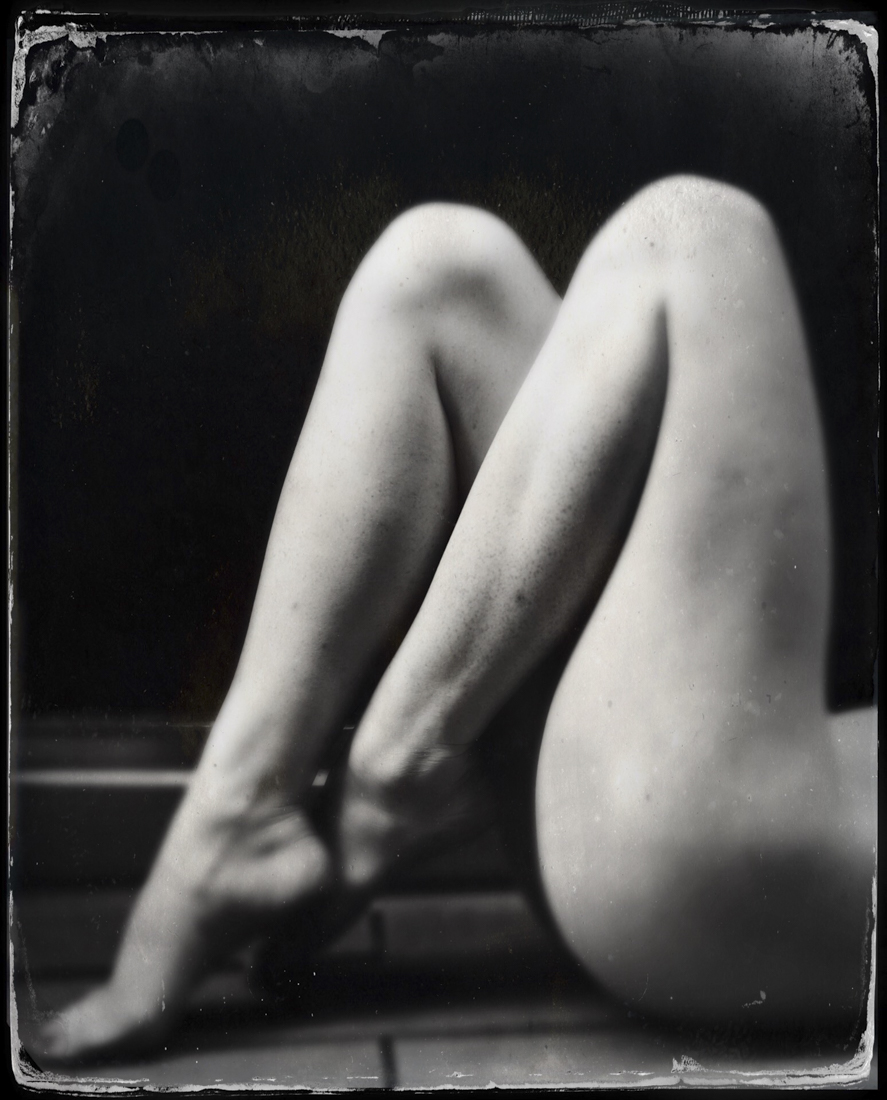 Legs