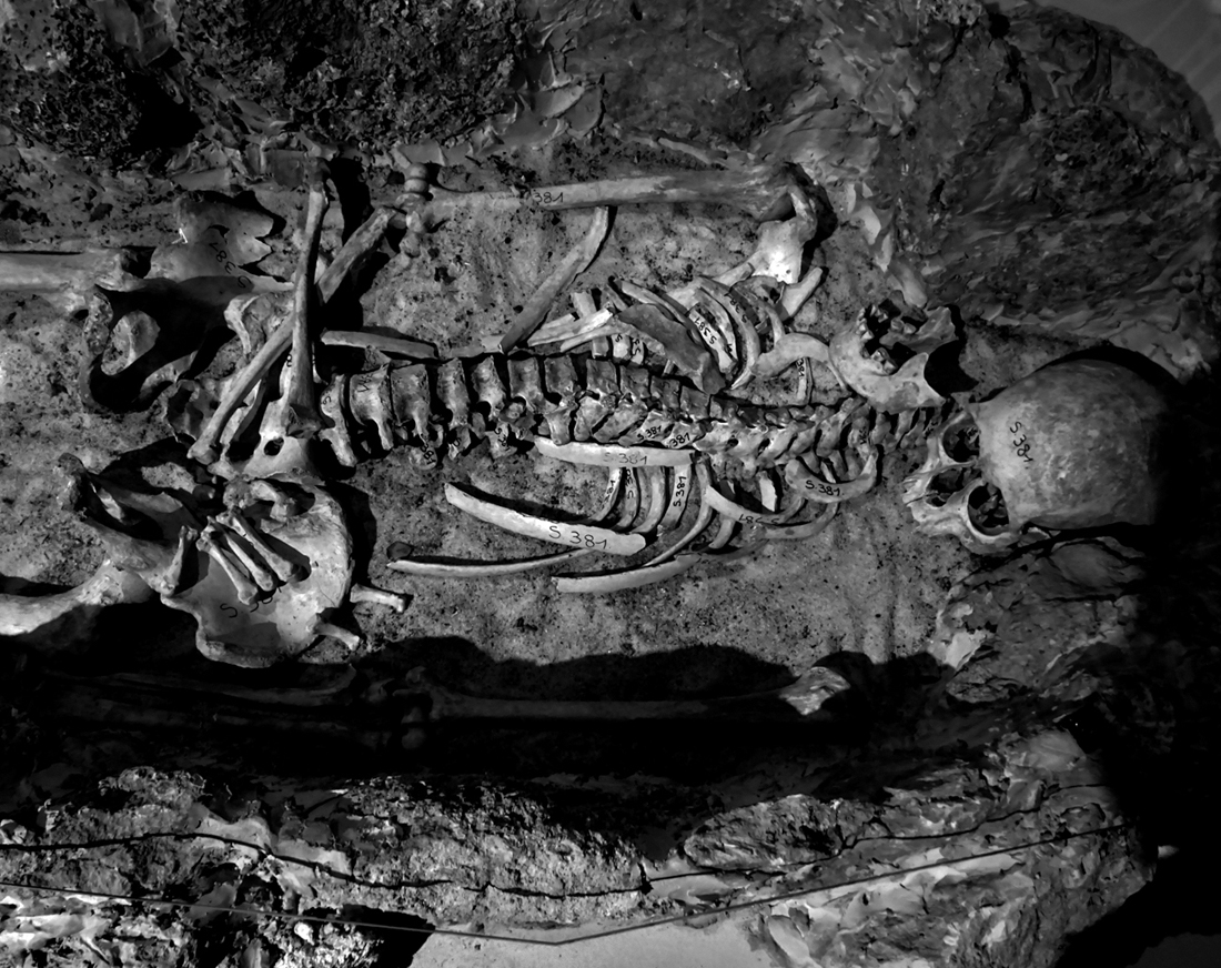 post mortem