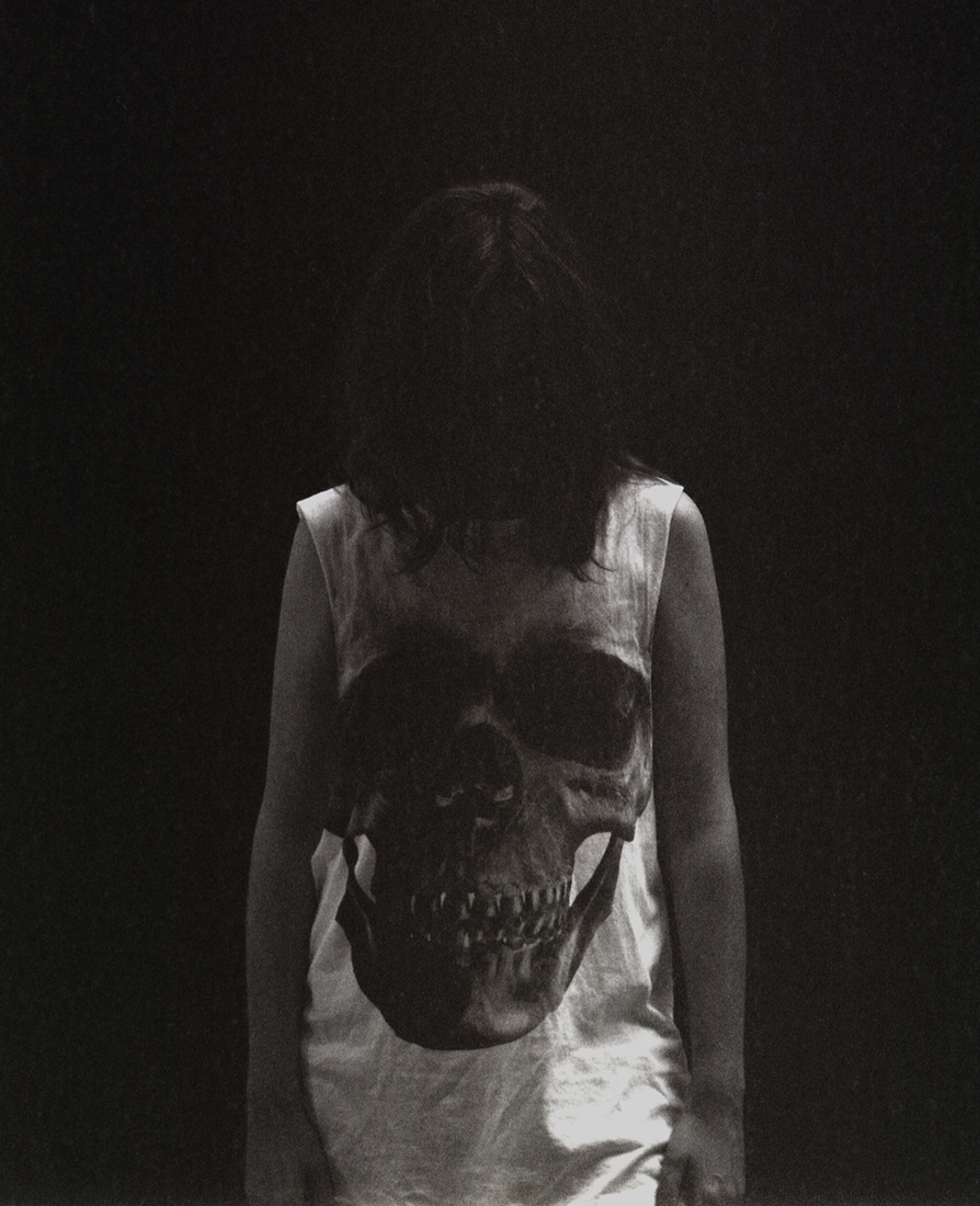 post mortem