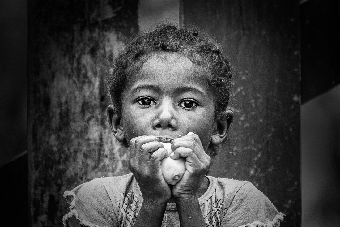 The eyes of Malagasy children 