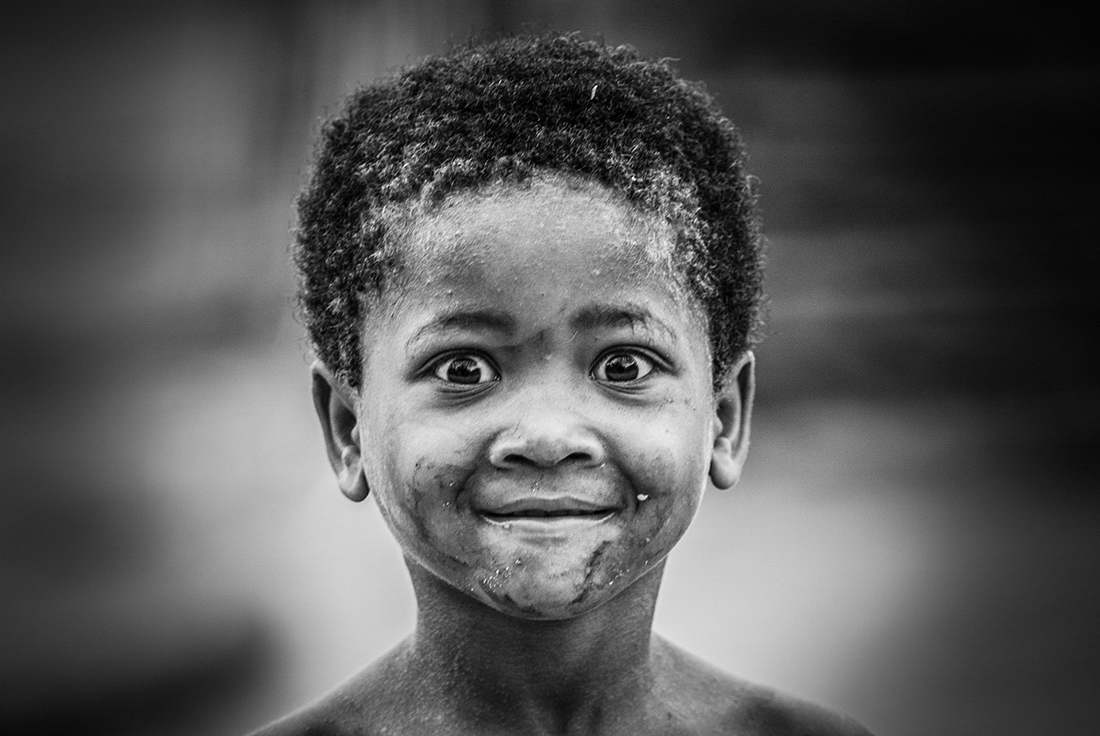 The eyes of Malagasy children 