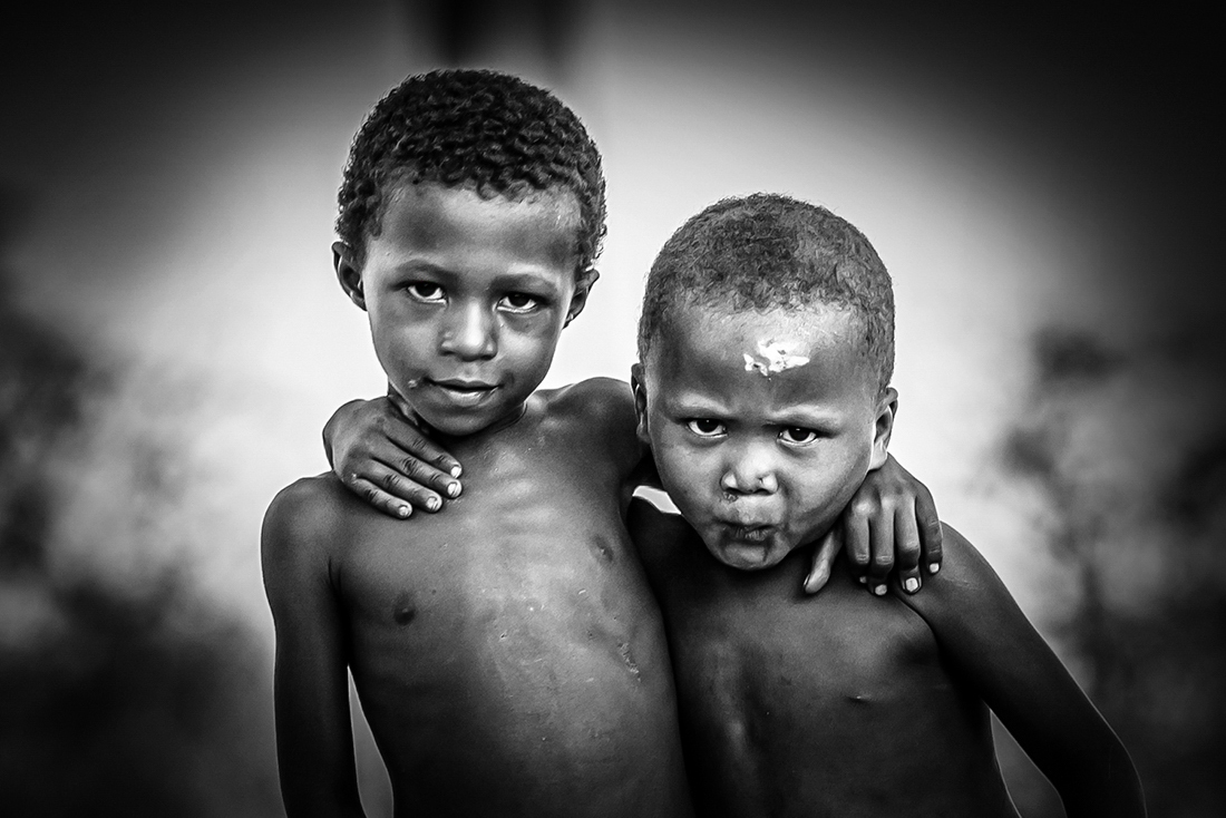 The eyes of Malagasy children 