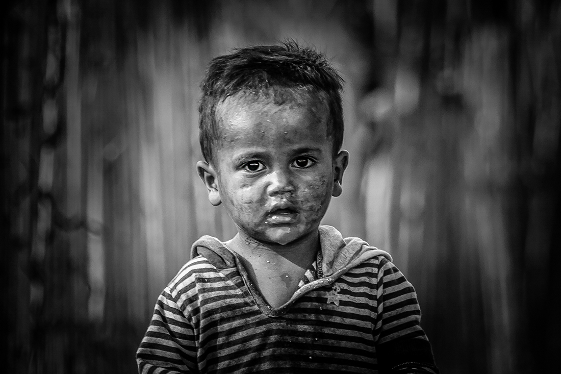 The eyes of Malagasy children 