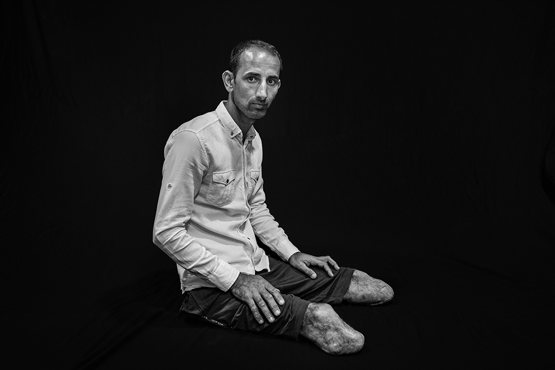 Open Wounds