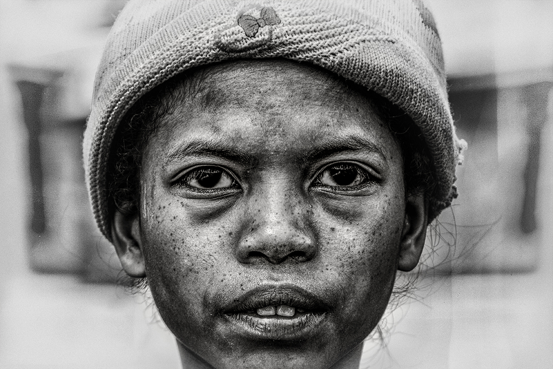 Malagasy Childhood
