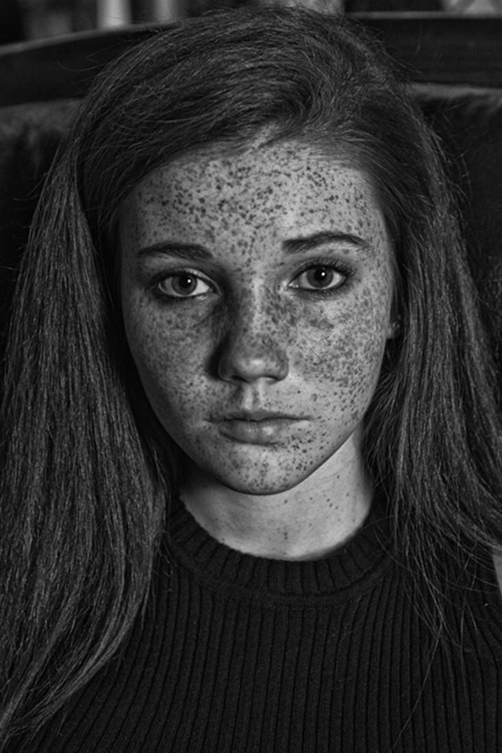 Katilyn Freckles