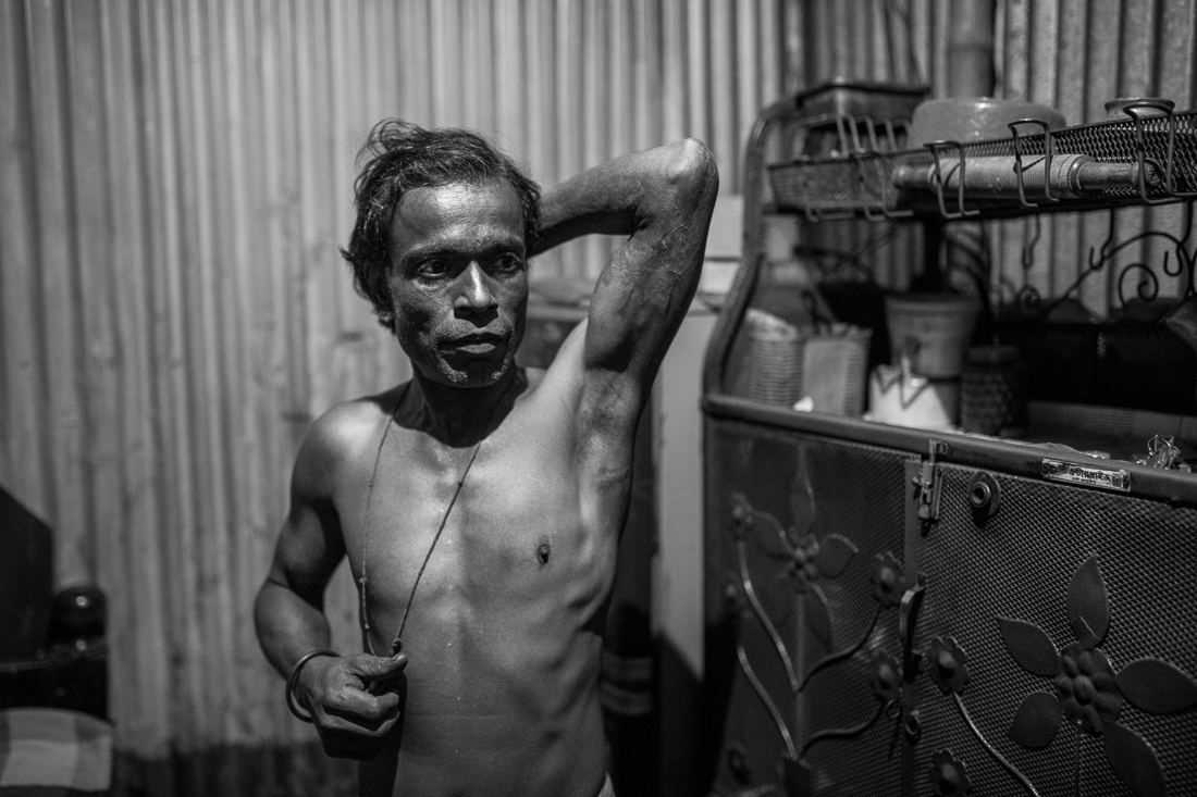 The dangerous job of recycling