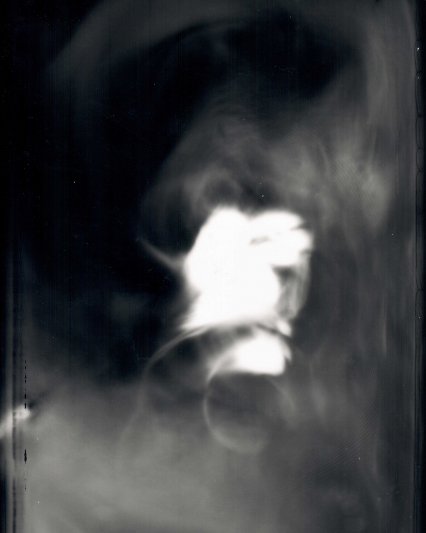 Breath