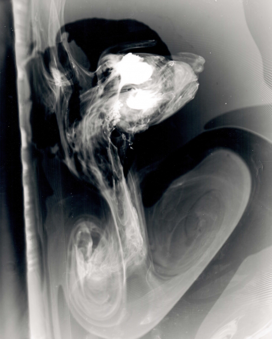Breath