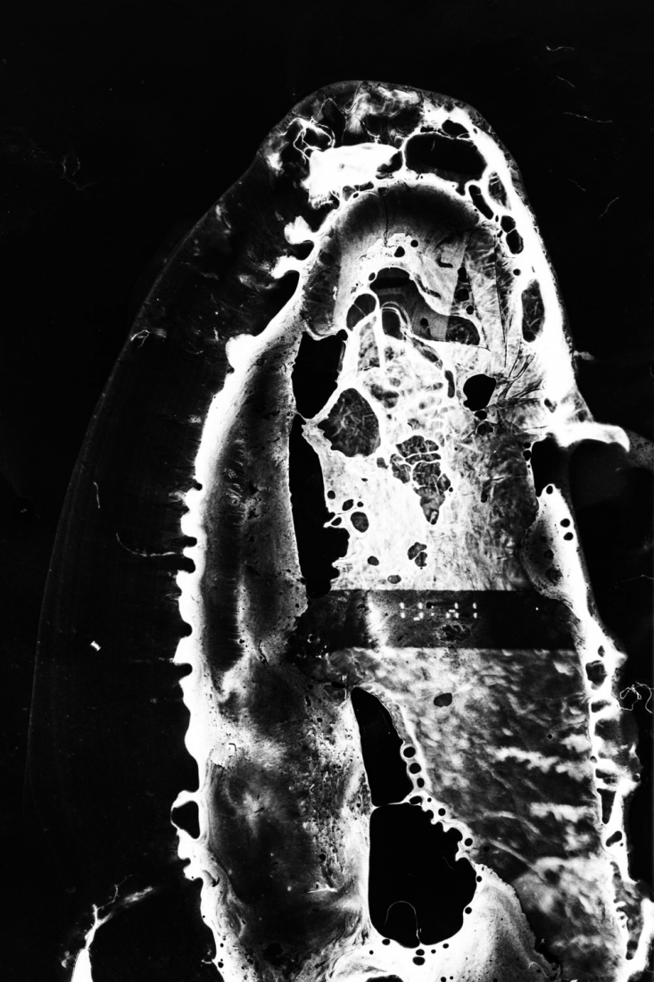 Parasite