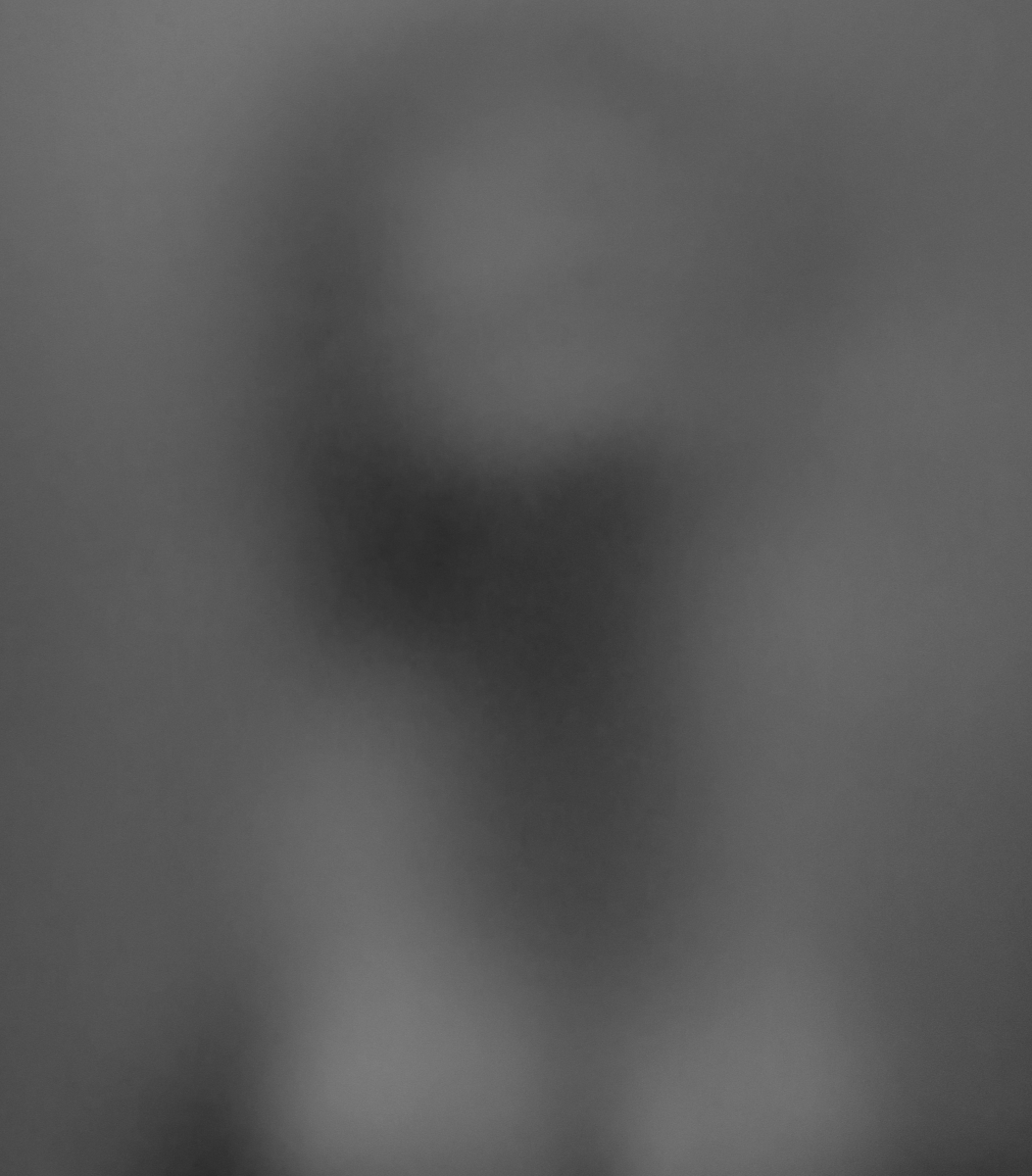 Embryo
