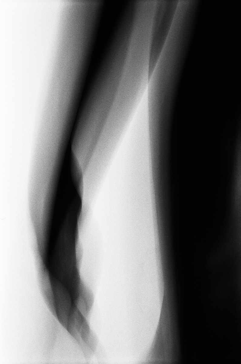 Between Worlds