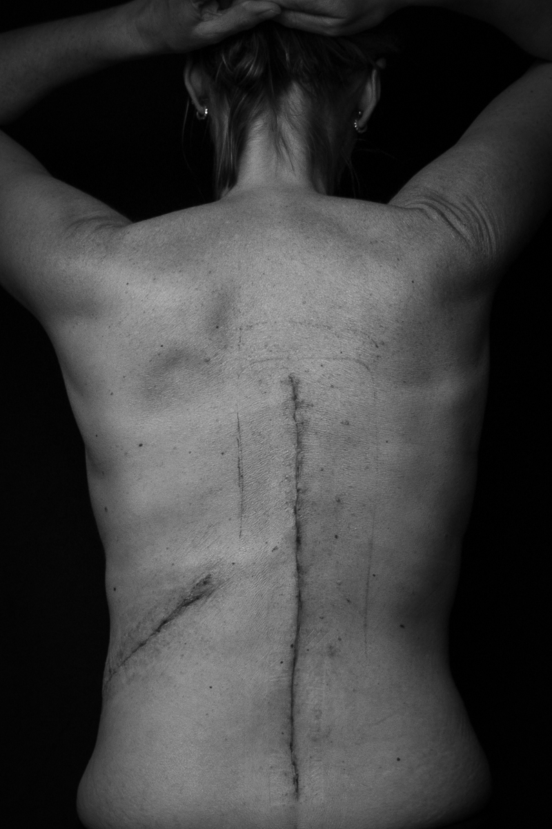 Bent Not Broken