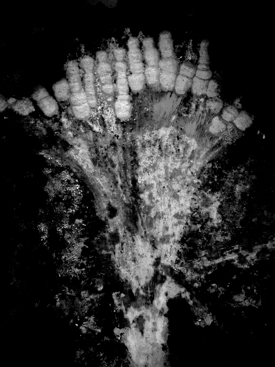 In X-rays