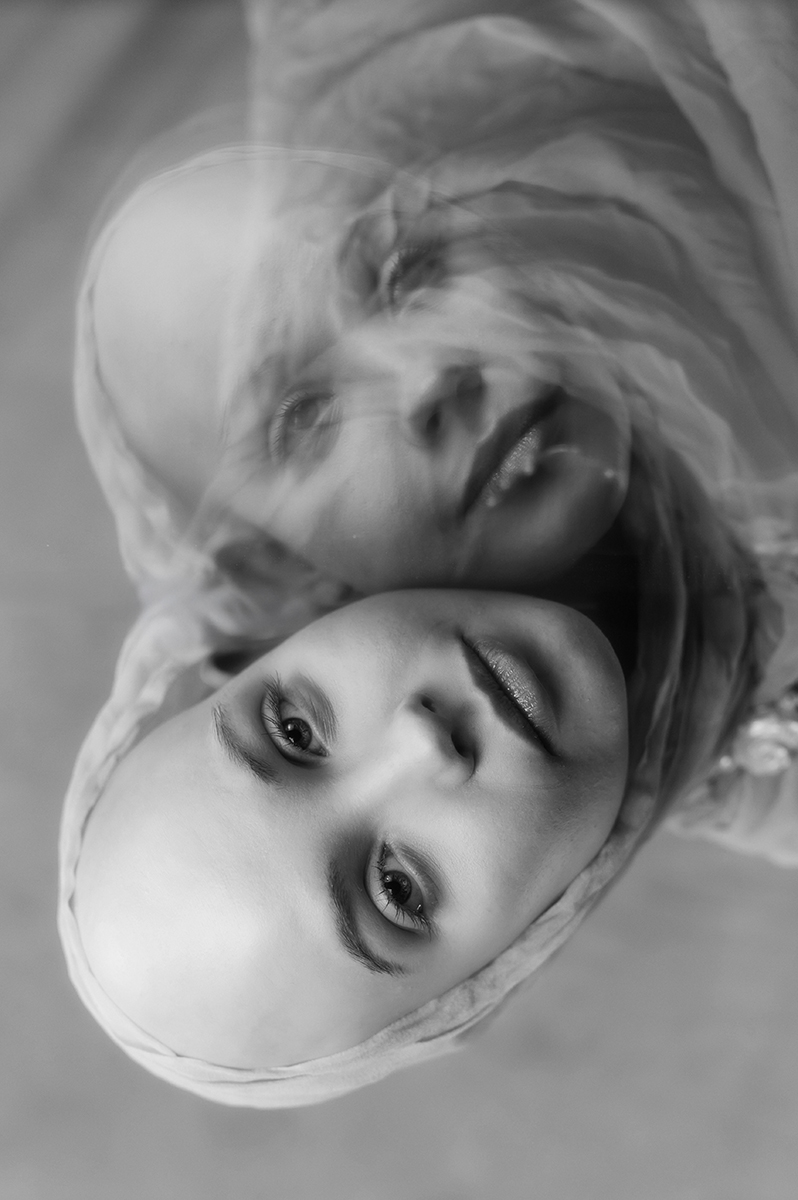 Alopecia