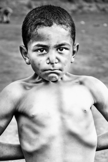 Childhood Displaced