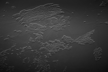 Surfaces unknown planet